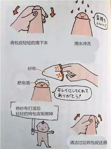 最后安利宝宝清洗包皮的方式