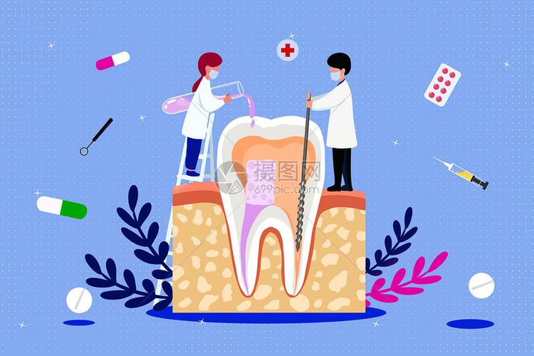 牙髓炎根管治疗扁平插画