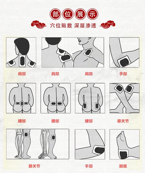 膏药贴牌之膏药的贴敷示意图