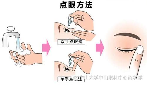 滴眼液,眼膏,眼用凝胶的使用方法,你掌握了吗?