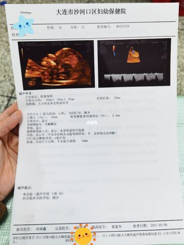 孕13周,nt_孕妇_母婴_孕产经验