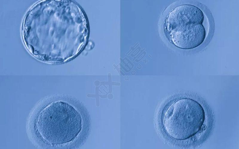 别再以为4bb囊胚男孩多,生男生女比例由2个因素决定