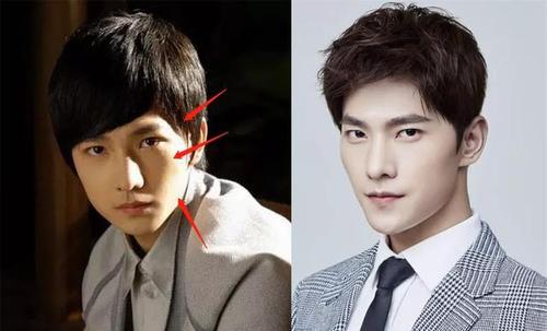 王嘉尔变成牙套脸?颧骨外扩太阳穴也凹陷,太多明星因此颜值骤降