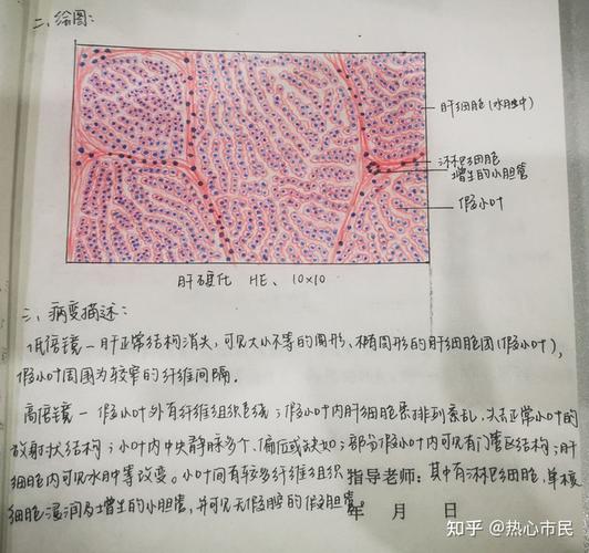 病理学红蓝铅笔手绘图实验报告病变描述