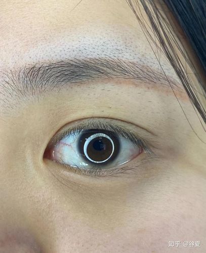 日常不够注意的话,假性干纹就会慢慢变成真性细纹.