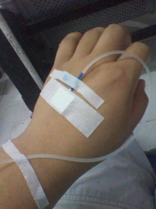 医院打针输液图片女生女生打针输液手真实