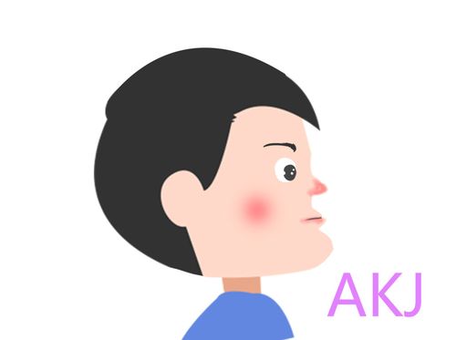 儿童地包天示意图片