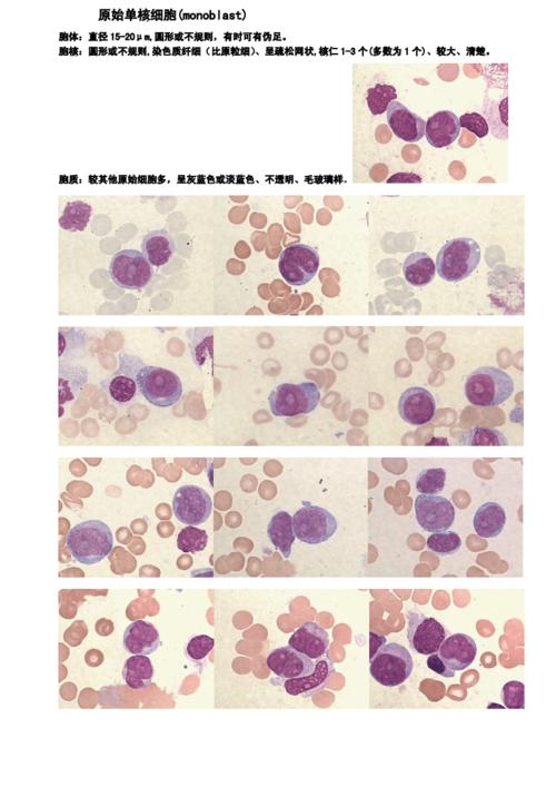 骨髓图片(单核系).doc 4页