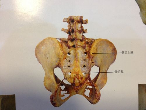 jpg   再说针具,个人认为,若以刺入骶孔为目标,针具以两寸针为好,因为