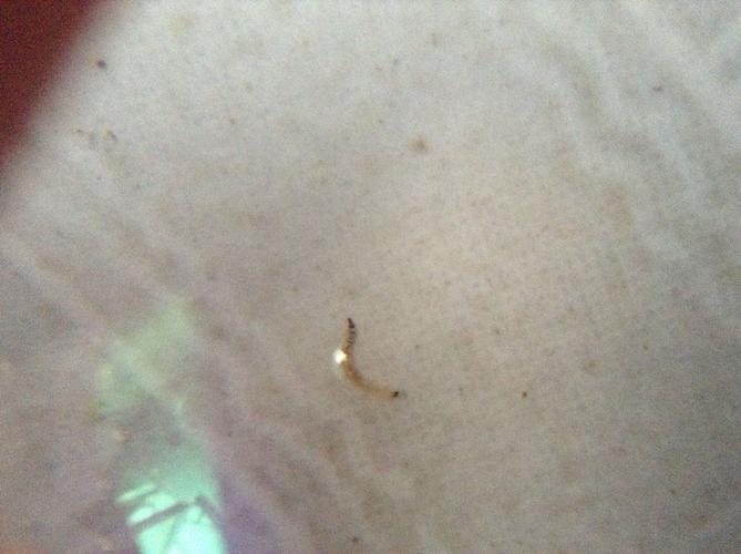 没有去医院看,自己吃了两粒肠虫清, 应该是蛲虫,钩虫,蛔虫幼