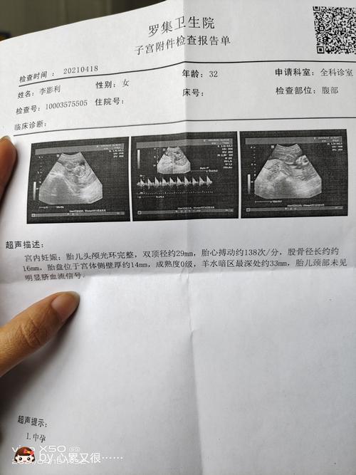 看看男孩女孩三个多月的彩超
