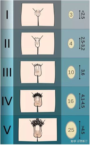 如果丁丁仍然太小或太细,丁丁勃起长度小于10cm,可诊断为丁丁短小症