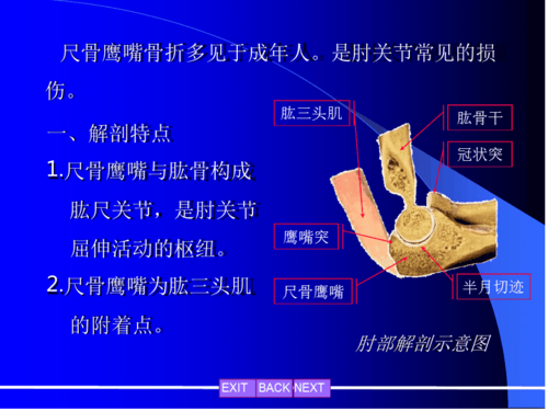 尺骨鹰嘴骨折完整版