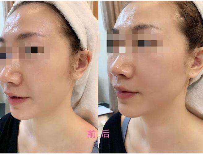 以此帖记录我人生里的~第一次~【热玛吉】,开诚布公的