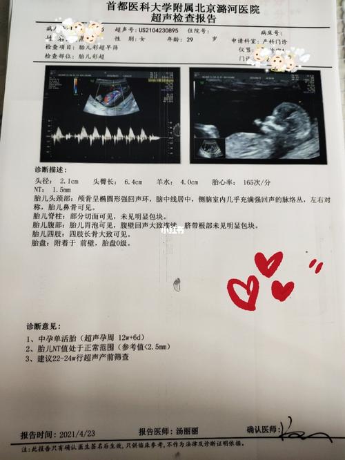nt过啦,宝宝马上就3个月啦_nt检查_宝马怎么样_胎儿_孕期_都挺好_孕期