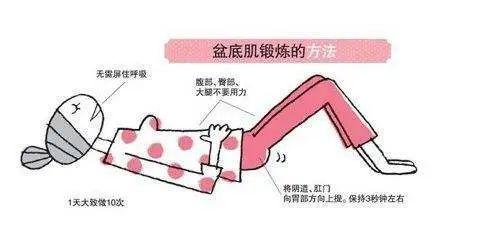 盆底电刺激治疗