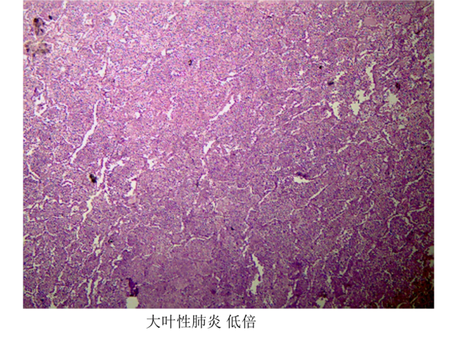 病理图片2.ppt