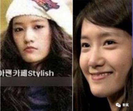 有旁人对比能更清楚的看出来允儿的下颌发育微微过度,造成轻微地包天