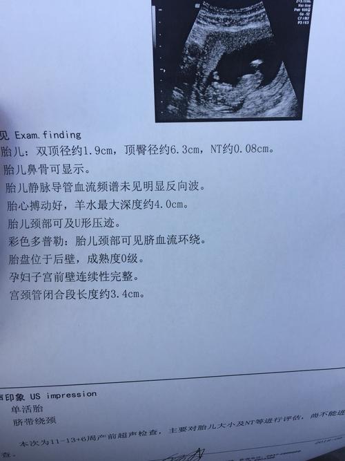 今天去做了nt,万幸一切都正常,但是为什么宝宝这个时候就脐带