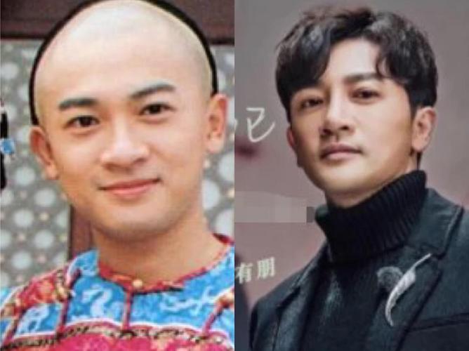 苏有朋屡次被传出"整容",本尊首次公开回应质疑