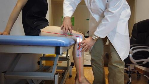 临床常见有的患者在膝关节为60度的时候,就觉得是90度了.