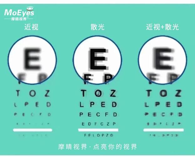 【摩睛科普】什么是散光?为什么会有散光?