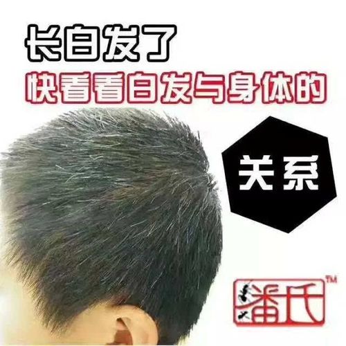 中医为你解答:出现白发的原因以及白发的症状表现.