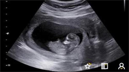 流产后休息几天最合适,告诉你哦