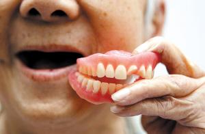 您想 装何种假牙