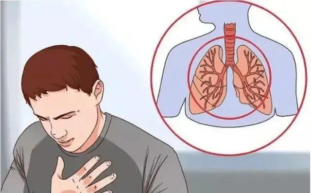 当身体的三处地方出现疼痛时,就需要警惕肺癌的发生!