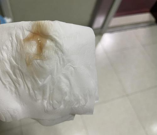 有图慎入.分泌物带颜色