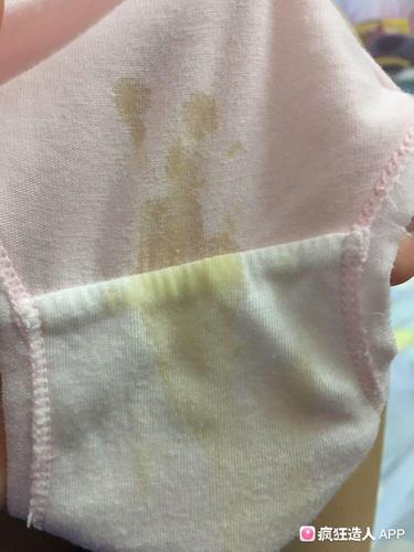 [试管婴儿]孕七周 和孕十周 ,都出现黄色分泌物流出,起初水状,干后