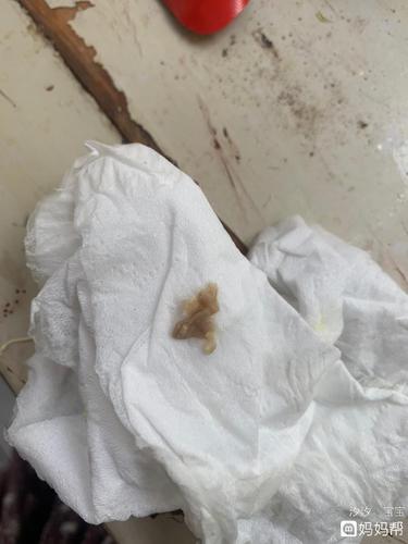 有宫颈糜烂.现在怀孕6个月.前两天突然伴