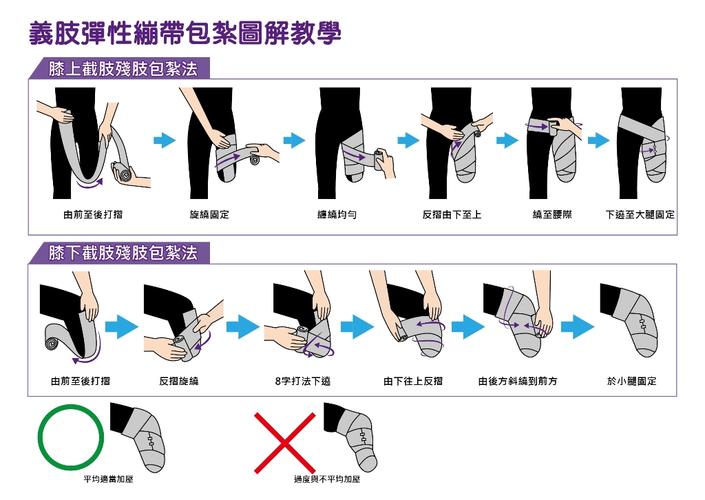 残肢弹性绷带包扎