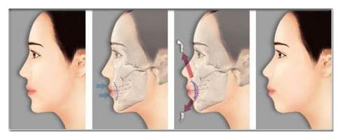 被明星的侧脸丑哭0101女神的侧颜塌还有救吗