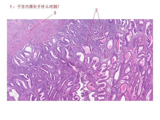 子宫内膜分泌期()