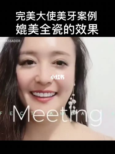 完美大使美牙效果,完美大使美牙怎么样?_美牙_完美大使_美妆_医美整形