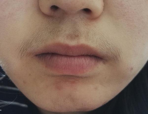 女生有唇毛(小胡子)是怎样的一种体验?
