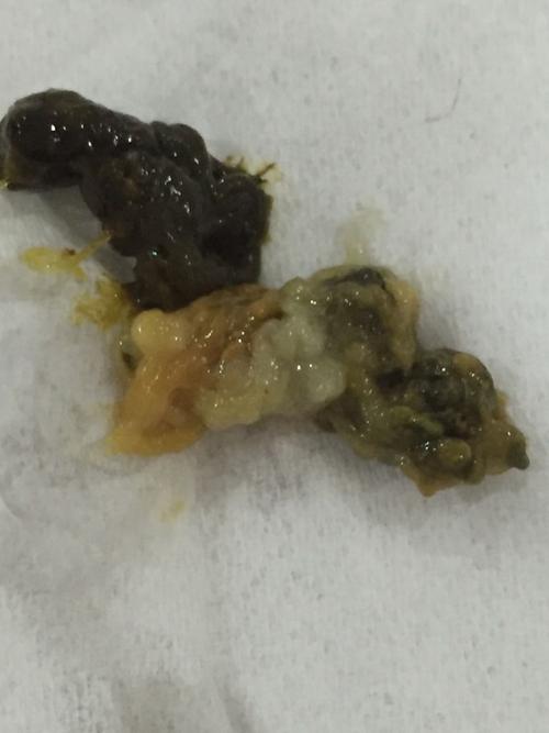十天大的小奶狗 拉屎是不是有问题?白色的是不是寄生虫?