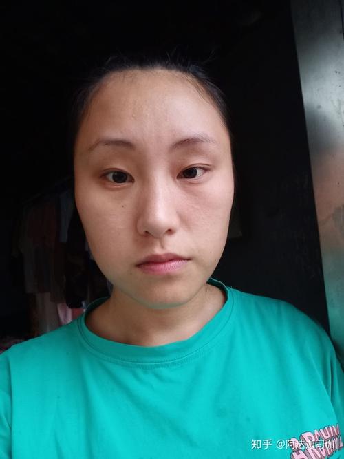 前置摄像头拍的照片跟后置天壤之别一个天上一个地上脸一大一小怎么