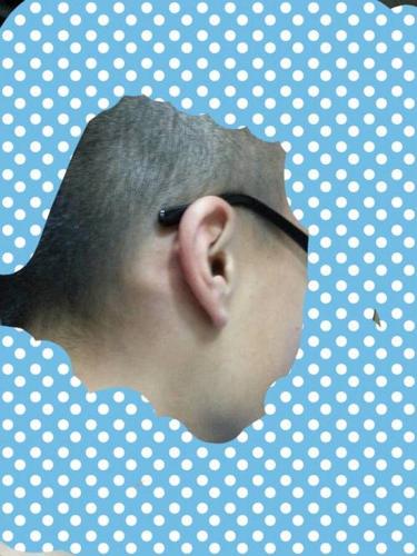 不痛不痒,很硬.医生给我说是骨头,到