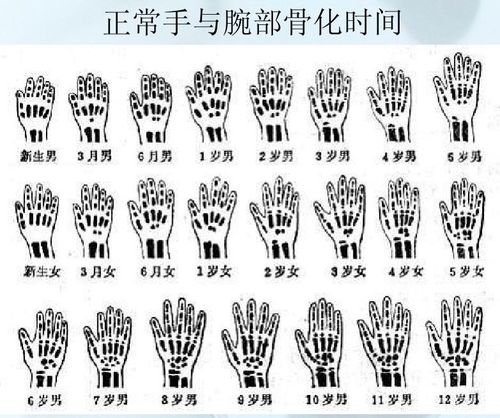 参考数据: 儿童身高体重标准表;;男1-19岁骨龄变化;;;4-18岁女孩骨龄