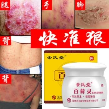 余氏堂 百藓灵 股藓膏 大腿内侧瘙痒股廯皮炎膏屁股痒 肛周外阴股癣
