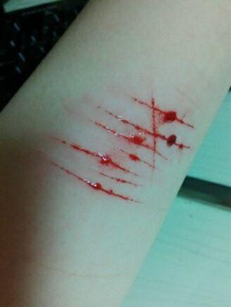 条回答  1 分钟前 xdeng1983|四级 从流血程度看是利器刚刚造成的伤口