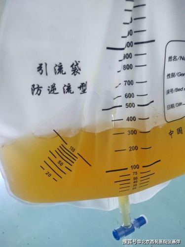 同样都是胸腔积液,为什么它们的颜色不一样?