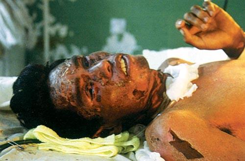 高中历史图片素材:中毒后的李贵珍