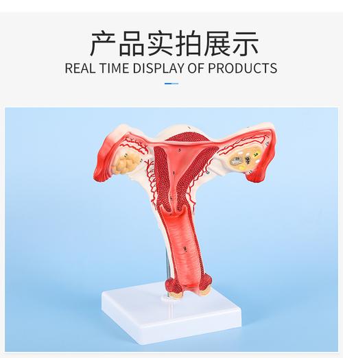 供应人体子宫解剖模型 卵巢内解剖模型女性 教学计生医用子宫模型