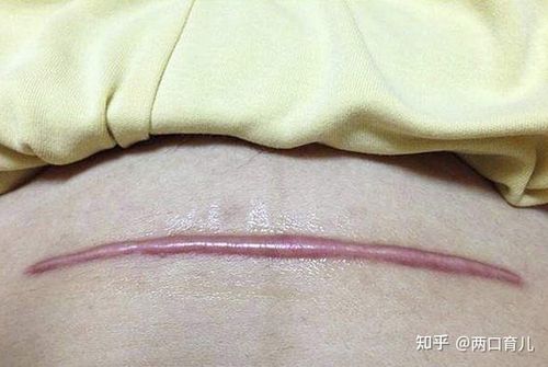 女人有没有生过孩子,从身体的这三个部位就能看出来,区别很明显