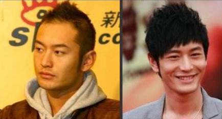 明星脱发也得治连周杰伦都用保法止