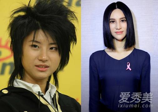 尚雯婕十年终于变美!6项整容手术没白做